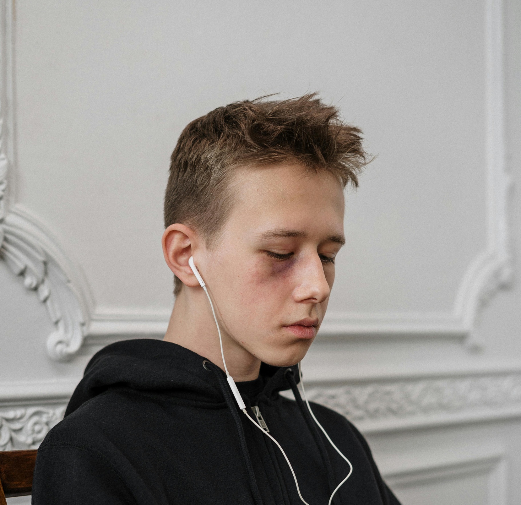 A teen with a black eye listens to music with a stressed expression. Learn how a complex PTSD therapist in Palm Beach, FL can offer support with coping with past trauma. Search for trauma treatment in Palm Beach County, FL and contact a trauma therapist in Delray Beach, FL today.